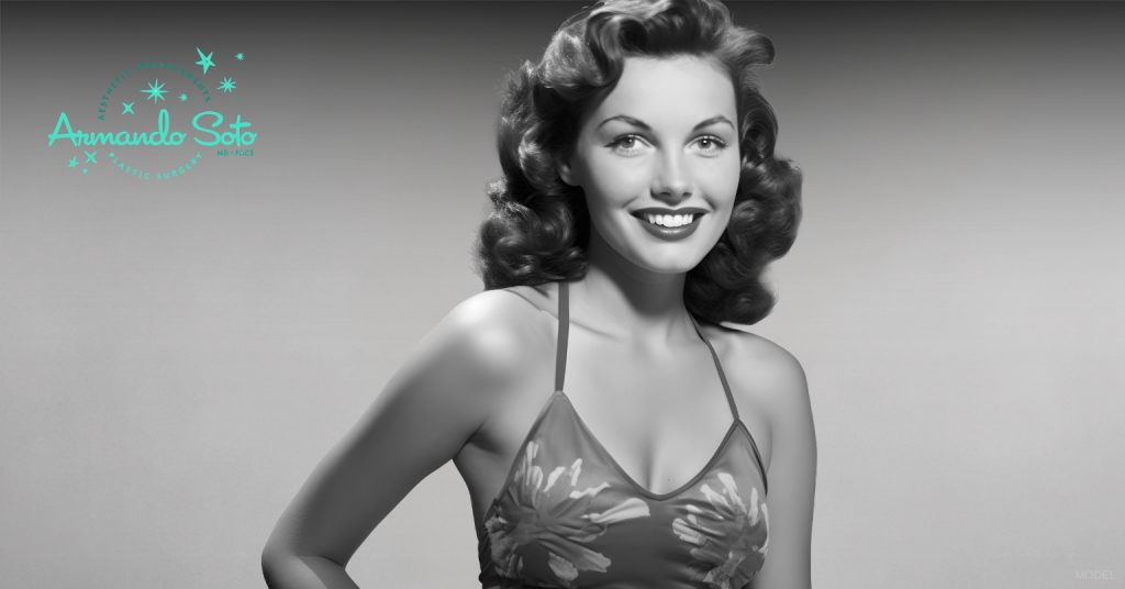 Woman after a breast lift. (Model)